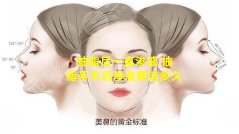 抽脂后一直渗液 抽脂手术后渗液要流多久